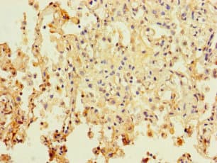 PAXIP1 / PTIP Antibody