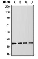 Polyclonal Rabbit anti-Human CRADD / RAIDD Antibody (Internal, WB)