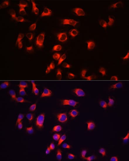 Polyclonal Rabbit anti-Human MAPT / Tau Antibody (IHC, IF, WB)
