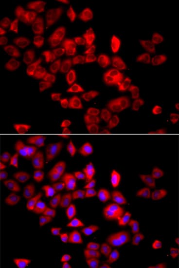 Polyclonal Rabbit anti-Human EIF4G1 / EIF4G Antibody (IHC, IF, WB)