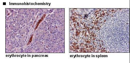 SLC4A1 / Band 3 / AE1 Antibody