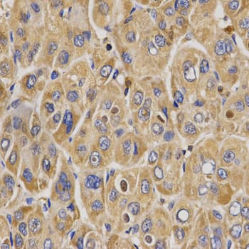WNK3 / PRKWNK3 Antibody