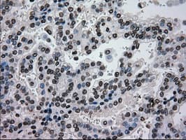 Monoclonal Mouse anti-Human GCK / Glucokinase Antibody (clone OTI3E3, IHC, IF, WB)