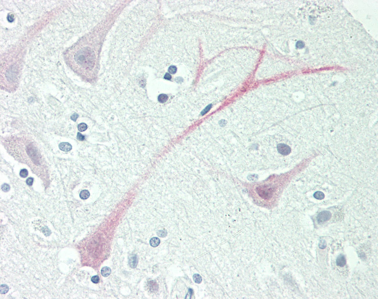 DARS Antibody (aa396-445)