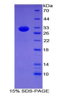 Mouse CD86 Protein (Recombinant His-T7)