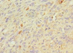 Polyclonal Rabbit anti-Human GRN / Granulin Antibody (aa20-310, IHC)