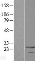 Human MED19 Protein (Over-Expression Lysate Myc-DDK (Flag))