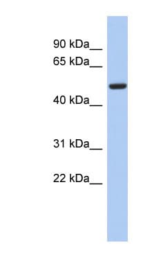 Polyclonal Rabbit anti-Human FBXO3 Antibody (aa35-84, WB)