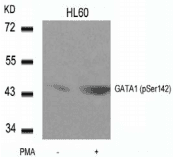 GATA1 Antibody