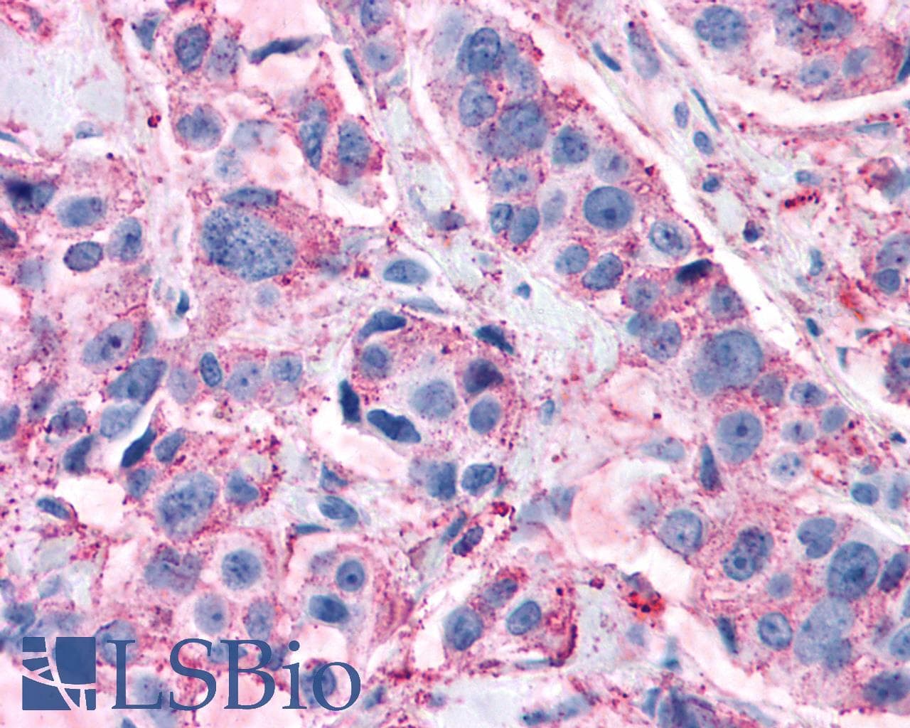 PathPlus™ GPR82 Antibody (Cytoplasmic Domain)