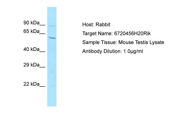 Polyclonal Rabbit anti-Mouse TMEM260 / C14orf101 Antibody (aa201-250, WB)