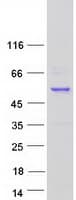 Human RAD52 Protein (Recombinant Myc-DDK (Flag))