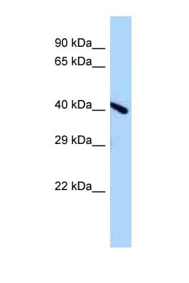 ENDOV Antibody (aa138-187)