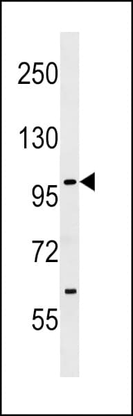 IHC-plus™ SIK1 / MSK Antibody (aa567-597)