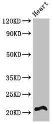 Polyclonal Rabbit anti-Human RCAN2 / RCN2 Antibody (IHC, IF, WB)