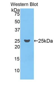 F9 / Factor IX Antibody (aa61-263)