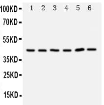 Polyclonal Rabbit anti-Human TRAM1 Antibody (aa314-331, IHC, WB)