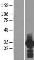 PDCL3 Protein (Over-Expression Lysate Myc-DDK (Flag))