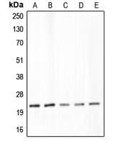 IHC-plus™ CLDN4 / Claudin 4 Antibody (C-Terminus)