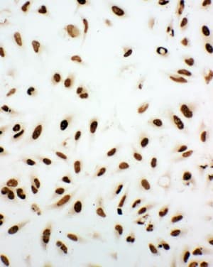 Polyclonal Rabbit anti-Human XRCC5 / Ku80 Antibody (aa648-662, IHC, WB)
