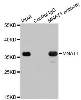 Polyclonal Rabbit anti-Human MNAT1 Antibody (IHC, IF, WB)