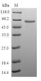 Human LIMS1 / PINCH Protein (Recombinant GST, N-terminus)