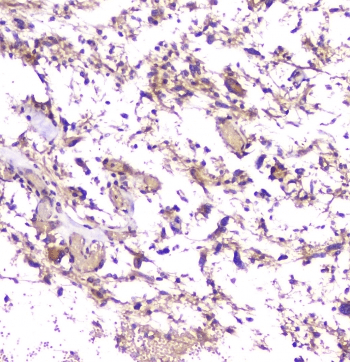 Beta Amyloid Antibody (aa672-702)