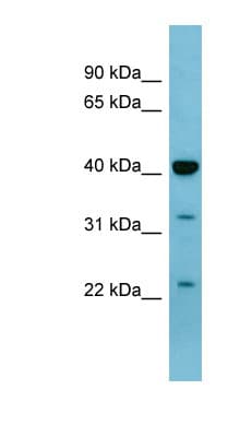 MAPK3 / ERK1 Antibody (aa251-300)