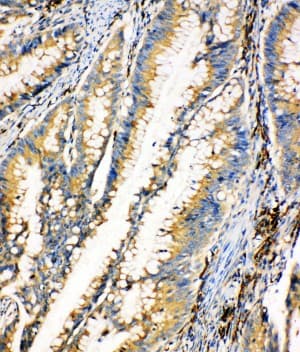 Polyclonal Rabbit anti-Human HEXA Antibody (aa191-207, IHC, WB)