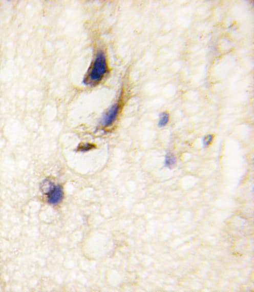 DAAM1 Antibody (aa1034-1063)