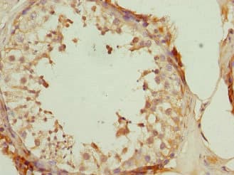 DUSP22 / JSP 1 Antibody
