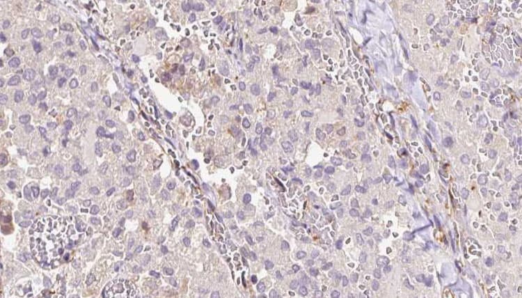 SAT1 / SAT Antibody