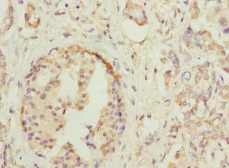 HOXD10 Antibody