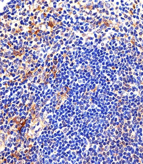LYN Antibody (aa229-263)