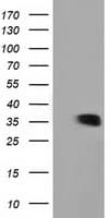 GRHPR / Glyoxylate Reductase Antibody (clone OTI4H2, Carrier-free)