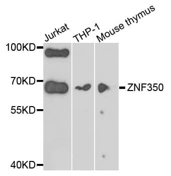 Polyclonal Rabbit anti-Human ZNF350 Antibody (IHC, WB)