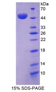 Human Osteonectin / SPARC Protein (Recombinant His-T7)