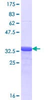Human SP4 Protein (Recombinant GST, N-terminus)