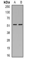 Polyclonal Rabbit anti-Human ASL / Argininosuccinate Lyase Antibody (IF, WB)