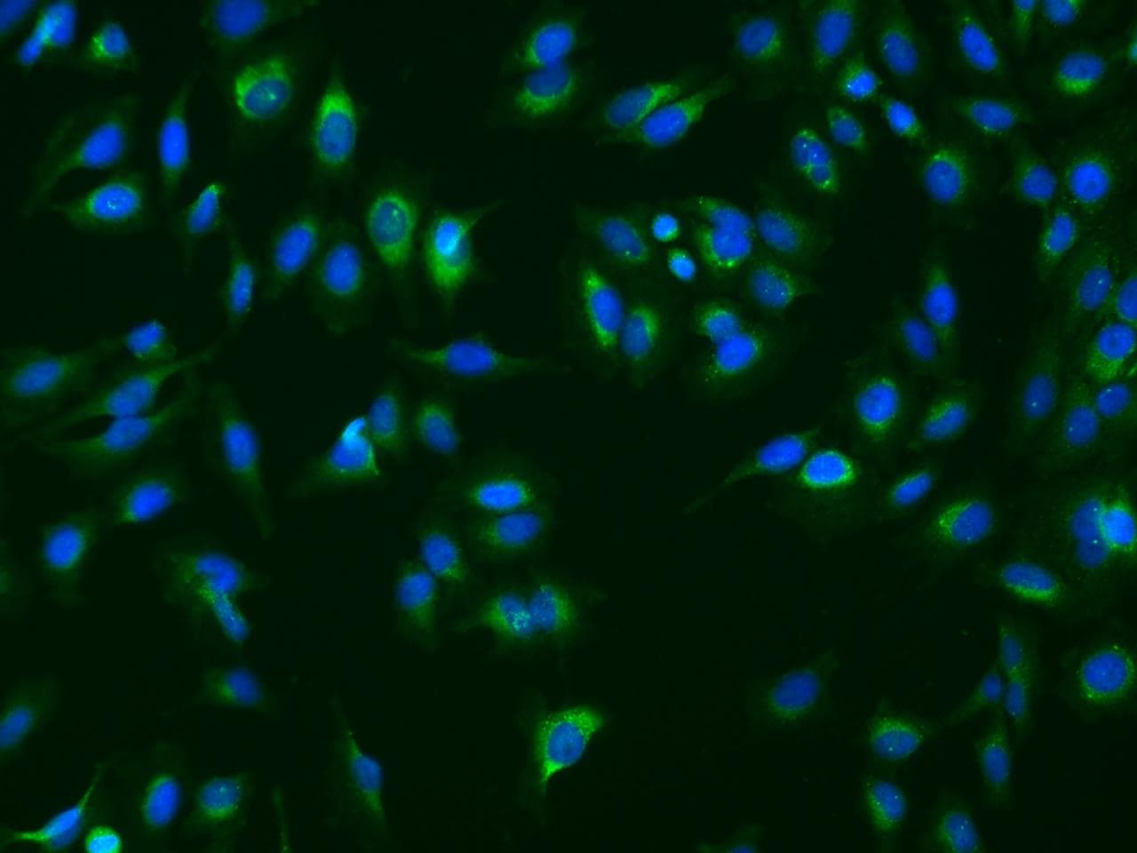 SERPINB3 Antibody