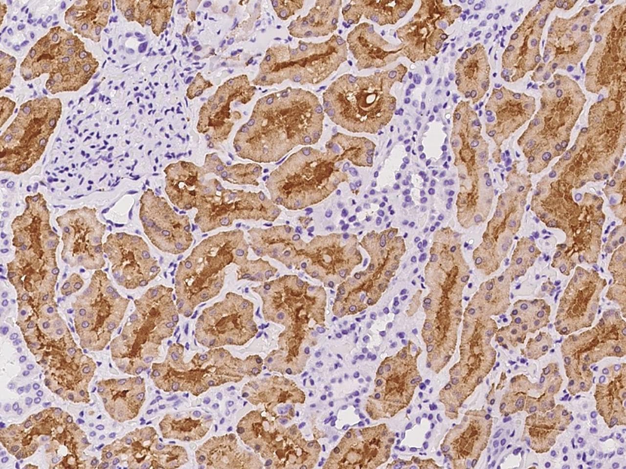 Polyclonal Rabbit anti-Human ALDOB Antibody (IHC)