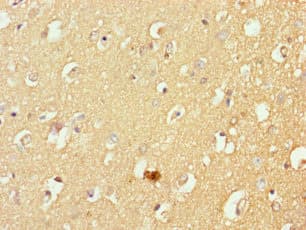 MFSD11 / ET Antibody