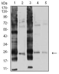 Monoclonal Mouse anti-Human RALB Antibody (clone 8A8A9, WB)