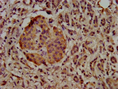 Polyclonal Rabbit anti-Human UBE2G1 Antibody (IHC, IF)