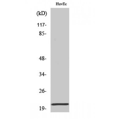 Polyclonal Rabbit anti-Human CTF1 / Cardiotrophin-1 Antibody (N-Terminal, IHC, WB)