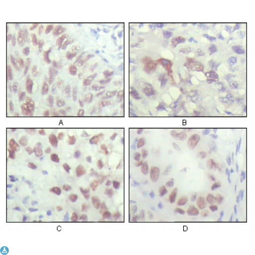 CHEK2 / CHK2 Antibody