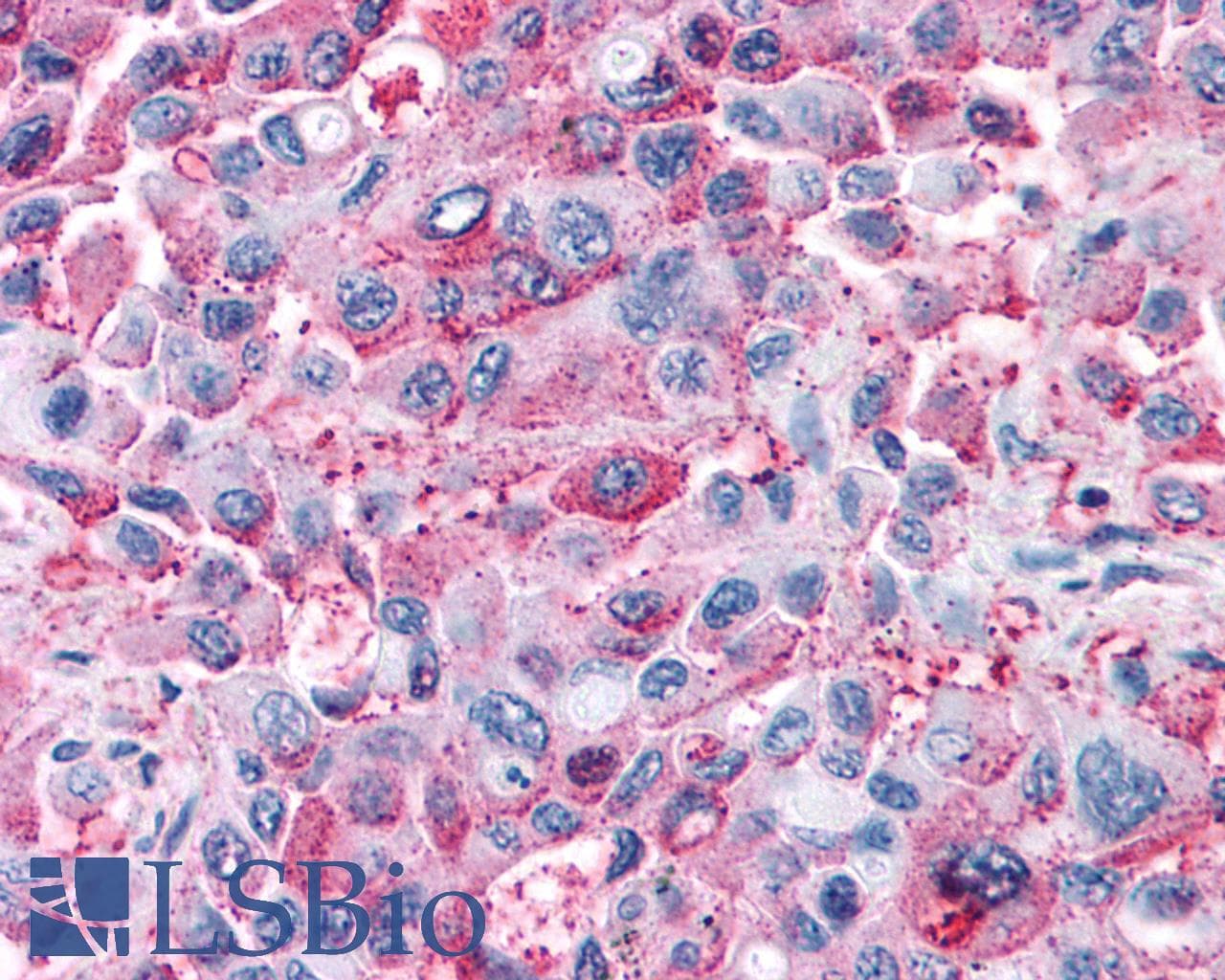 PathPlus™ GPR82 Antibody (Cytoplasmic Domain)