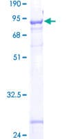 Human FAM113A Protein (Recombinant GST)
