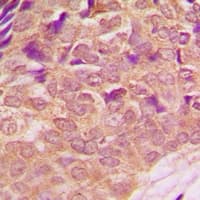PIK3R1 / p85 Alpha Antibody (C-Terminus)