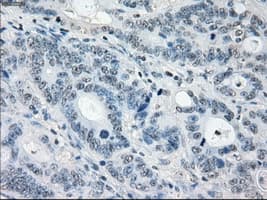 MAP2K1 / MKK1 / MEK1 Antibody (clone OTI1F5)